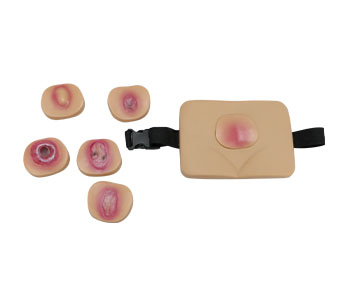 Wearable pressure ulcer  disease evolution simulator