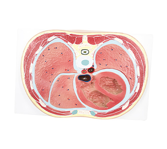 Thoracic transverse section