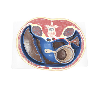 Abdominal transverse section