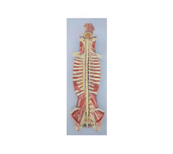 Spinal canal internal spinal nerve simulator