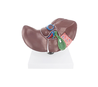 Hepatobiliary stone simulator